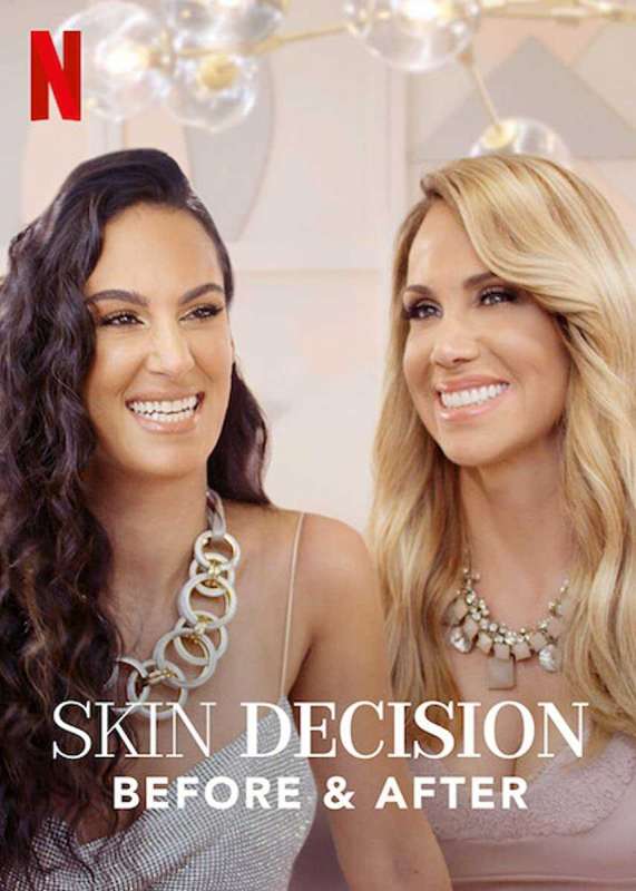 برنامج Skin Decision: Before and After الموسم الاول حلقة 3